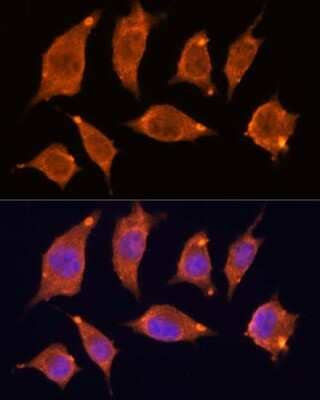 Immunocytochemistry/Immunofluorescence: ATF5 Antibody [NBP2-92397] - Analysis of L929 cells using ATF5 at dilution of 1:100. Blue: DAPI for nuclear staining.