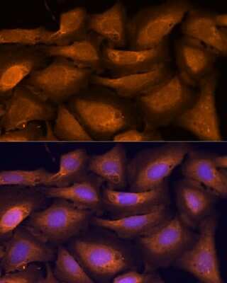 Immunocytochemistry/Immunofluorescence: ATF5 Antibody [NBP2-92397] - Analysis of U-2 OS cells using ATF5 at dilution of 1:100. Blue: DAPI for nuclear staining.