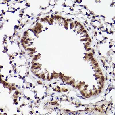 Immunohistochemistry-Paraffin: ATF5 Antibody [NBP2-92397] - Mouse lung using ATF5 Rabbit pAb (NBP2-92397) at dilution of 1:25 (40x lens). Perform high pressure antigen retrieval with 10 mM citrate buffer pH 6.0 before commencing with IHC staining protocol.