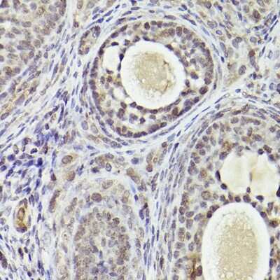 Immunohistochemistry-Paraffin: ATF5 Antibody [NBP2-92397] - Rat ovary using ATF5 Rabbit pAb (NBP2-92397) at dilution of 1:25 (40x lens). Perform high pressure antigen retrieval with 10 mM citrate buffer pH 6.0 before commencing with IHC staining protocol.