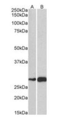 Western Blot: ATF5 Antibody [NBP1-51908] -  Staining of Mouse (A) and Rat (B) Skeletal Muscle lysate (35ug protein in RIPA buffer). Primary incubation was 1 hour. Detected by chemiluminescence.