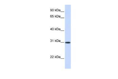 Western Blot: ATF5 Antibody [NBP3-10651] - Western blot analysis using NBP3-10651 on Human Liver  as a positive control. Antibody Titration: 0.2-1 ug/ml