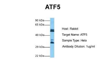 Western Blot: ATF5 Antibody [NBP3-10891] - Western blot analysis of ATF5 in Human Hela. Antibody dilution at 1.0ug/ml