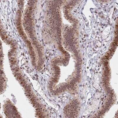 Immunohistochemistry-Paraffin: ATF6 beta Antibody [NBP1-91687] - Staining of human Fallopian tube shows moderate nuclear positivity in glandular cells.