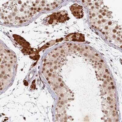 Immunohistochemistry-Paraffin: ATF6 beta Antibody [NBP1-91687] - Staining of human testis shows strong nuclear  and cytoplasmic positivity in Leydig cells.