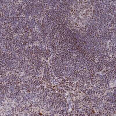 Immunohistochemistry-Paraffin: ATF6 beta Antibody [NBP1-91687] - Staining of human lymph node shows moderate nuclear positivity in non-germinal center cells.