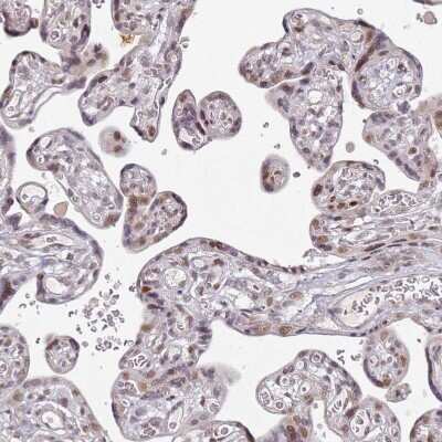 Immunohistochemistry-Paraffin: ATF6 beta Antibody [NBP1-91687] - Staining of human placenta shows moderate nuclear positivity in trophoblastic cells.