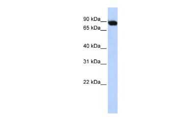Western Blot: ATF6 beta Antibody [NBP2-84474] - WB Suggested Anti-CREBL1 Antibody Titration: 0.2-1 ug/ml. ELISA Titer: 1:1562500. Positive Control: Human Muscle