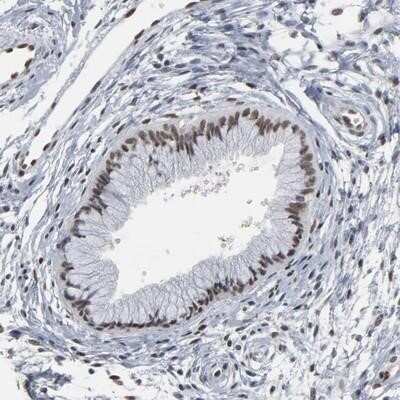Immunohistochemistry-Paraffin ATF7 Antibody - BSA Free