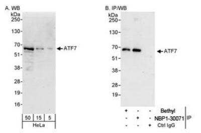 Immunoprecipitation: ATF7 Antibody [NBP1-30071] - Whole cell lysate from HeLa cells. ATF7 was also immunoprecipitated by rabbit anti-ATF7 antibody. For blotting immunoprecipitated ATF7, the ReliaBLOT(R) Reagents and Procedures were used.