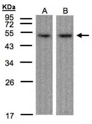 Western Blot ATF7 Antibody - BSA Free