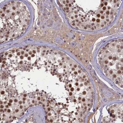 Immunohistochemistry-Paraffin ATF7IP2 Antibody - BSA Free