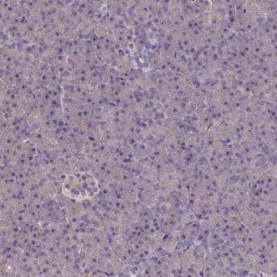 Immunohistochemistry-Paraffin ATF7IP2 Antibody - BSA Free