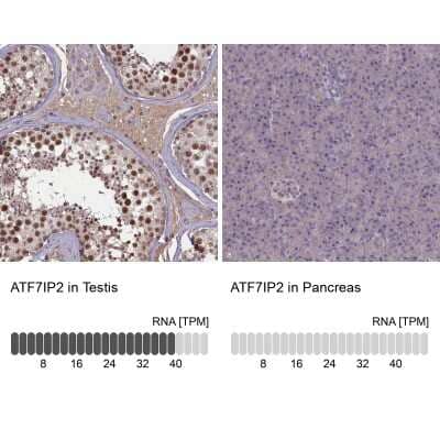 Immunohistochemistry-Paraffin ATF7IP2 Antibody - BSA Free