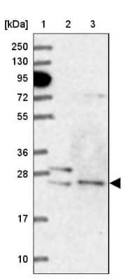 Western Blot: ATG101 Antibody [NBP1-88877] - Lane 1: Marker  [kDa] 250, 130, 95, 72, 55, 36, 28, 17, 10.  Lane 2: Human cell line RT-4.  Lane 3: Human cell line U-251MG sp