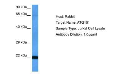 Western Blot: ATG101 Antibody [NBP2-82701] - Host: Rabbit. Target Name: ATG101. Sample Tissue: Human Jurkat Whole Cell lysates. Antibody Dilution: 1ug/ml