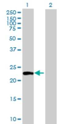 Western Blot: ATG12 Antibody [H00009140-B01P] - Analysis of ATG12 expression in transfected 293T cell line by ATG12 polyclonal antibody.  Lane 1: ATG12 transfected lysate(20.57 KDa). Lane 2: Non-transfected lysate.