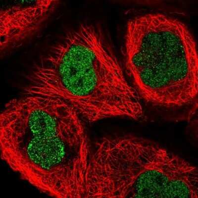 Immunocytochemistry/Immunofluorescence: ATG16L2 Antibody [NBP2-14326] - Immunofluorescent staining of human cell line A-431 shows localization to nucleoplasm.