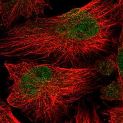 Immunocytochemistry/Immunofluorescence: ATG16L2 Antibody [NBP2-58308] - Staining of human cell line U-251 MG shows localization to nucleoplasm.