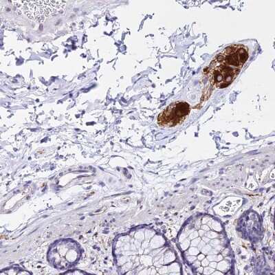 Immunohistochemistry-Paraffin: ATG16L2 Antibody [NBP2-14326] - Staining of human colon shows strong cytoplasmic positivity in ganglion cells.