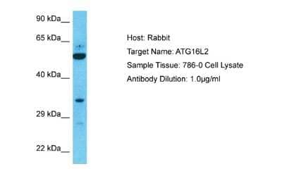 Western Blot: ATG16L2 Antibody [NBP2-84477] - Host: Rabbit. Target Name: ATG16L2. Sample Type: 786-0 Whole Cell lysates. Antibody Dilution: 1.0ug/ml