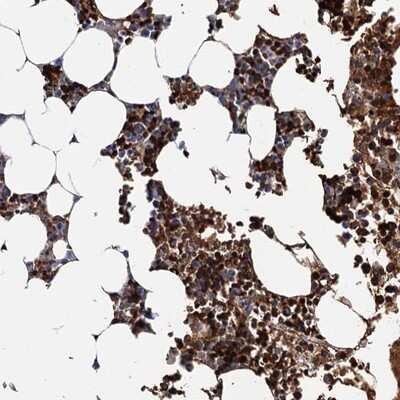 Immunohistochemistry-Paraffin: ATG2A Antibody [NBP1-83009] - Staining of human bone marrow shows strong cytoplasmic positivity in subsets of bone marrow poietic cells and red blood cells.