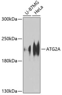 Western Blot: ATG2A Antibody [NBP2-92562] - Analysis of extracts of various cell lines, using ATG2A at 1:1000 dilution.Secondary antibody: HRP Goat Anti-Rabbit IgG (H+L) at 1:10000 dilution.Lysates/proteins: 25ug per lane.Blocking buffer: 3% nonfat dry milk in TBST.Detection: ECL Basic Kit .Exposure time: 60s.