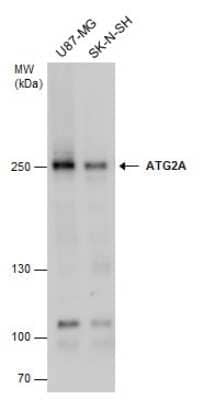 Western Blot: ATG2A Antibody [NBP3-13028] - ATG2A antibody detects ATG2A protein by western blot analysis. Various whole cell extracts (30 ug) were separated by 5% SDS-PAGE, and the membrane was blotted with ATG2A antibody (NBP3-13028) diluted at a dilution of 1:1000.