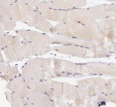 Immunohistochemistry-Paraffin: ATG2B Antibody [NBP1-90732] - Staining of human skeletal muscle shows very weak cytoplasmic positivity in myocytes.