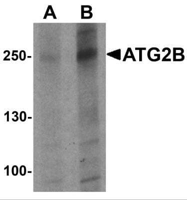 Western Blot: ATG2B Antibody [NBP2-81706] - Analysis of ATG2B in K562 cell lysate with ATG2B antibody at (A) 1 and (B) 2 ug/ml.