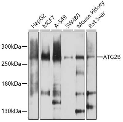 Western Blot: ATG2B Antibody [NBP2-92551] - Analysis of extracts of various cell lines, using ATG2B .Exposure time: 60s.