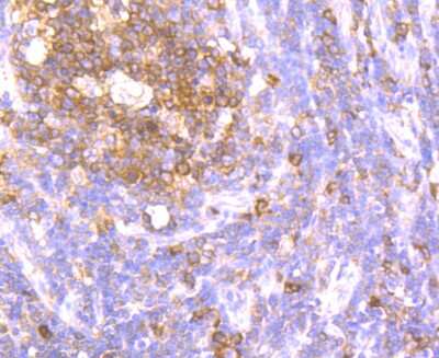 Immunohistochemistry-Paraffin: ATG3/APG3 Antibody (JU00-35) [NBP2-75414] - Analysis of paraffin-embedded human tonsil tissue using anti-Apg3 antibody. Counter stained with hematoxylin.