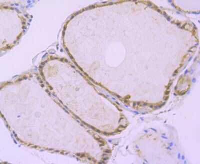 Immunohistochemistry-Paraffin: ATG3/APG3 Antibody (JU00-35) [NBP2-75414] - Analysis of paraffin-embedded human thyroid gland tissue using anti-Apg3 antibody. Counter stained with hematoxylin.