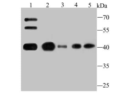 Western Blot: ATG3/APG3 Antibody (JU00-35) [NBP2-75414] - Analysis of Apg3 on different lysates using anti-Apg3 antibody at 1/500 dilution.Positive control:Lane 1: Mouse testis tissue     Lane 2: K562   Lane 3: HL-60  Lane 4: Hela     Lane 5: Jurkat