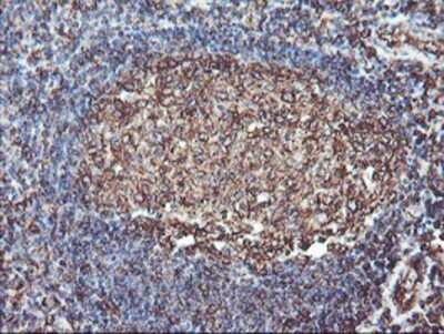 Immunohistochemistry: ATG3/APG3 Antibody (OTI3H2) - Azide and BSA Free [NBP2-72140] - Staining of paraffin-embedded Human tonsil using anti-Apg3 mouse monoclonal antibody.