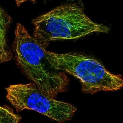 Immunocytochemistry/Immunofluorescence: ATG4A Antibody [NBP2-56465] - Staining of human cell line PC-3 shows localization to microtubules.