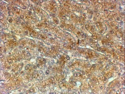 Immunohistochemistry-Paraffin: ATG4A Antibody [NBP2-42518] - Analysis of Human Liver shows textured cytoplasm staining in the hepatocytes.