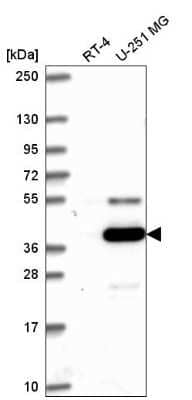 Western Blot: ATG4A Antibody [NBP2-56465] - Western blot analysis in human cell line RT-4 and human cell line U-251 MG.