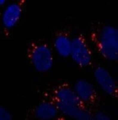 Immunocytochemistry/Immunofluorescence: ATG5 Antibody - BSA Free [NB110-53818] - ICC/IF analysis of SY5Y cells at 1:250. Incubated overnight at 4 degrees. Photo courtesy of an anonymous collaborator.