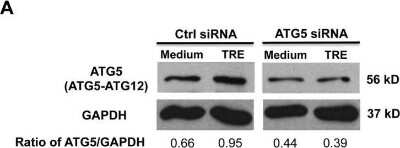 <b>Genetic Strategies Validation. </b>Western Blot: ATG5 Antibody - BSA Free [NB110-53818] - Knockdown of autophagy-related gene 5 (ATG5) inhibits trehalose-induced autophagy in normal human primary airway epithelial cells. Normal human tracheobronchial epithelial cells were transfected with Naito1 chimera RNAi (control siRNA) or ATG5 chimera siRNA (ATG5 siRNA). Twenty-four hours after siRNA transfection, cells were treated with medium or trehalose (TRE, 100 mM) for 48 h. ATG5 protein as examined by Western blot analysis with GAPDH protein used as loading control. The representative Western blot picture was shown from 2 independent experiments with each being performed in triplicate wells.