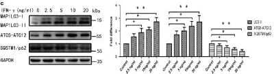 <b>Biological Strategies Validation. </b>ATG5-Antibody---BSA-Free-Western-Blot-NB110-53818-img0017.jpg