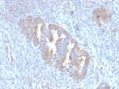 Immunohistochemistry-Paraffin: ATG5 Antibody (ATG5/2101) [NBP3-08504] - Formalin-fixed, paraffin-embedded human Endometrium stained with ATG5 Mouse Monoclonal Antibody (ATG5/2101).