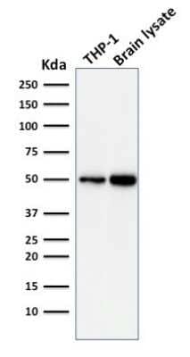 Western Blot: ATG5 Antibody (ATG5/2101) [NBP3-08504] - Western Blot Analysis of THP-1 cell and human Brain tissue lysate using ATG5 Mouse Monoclonal Antibody (ATG5/2101).