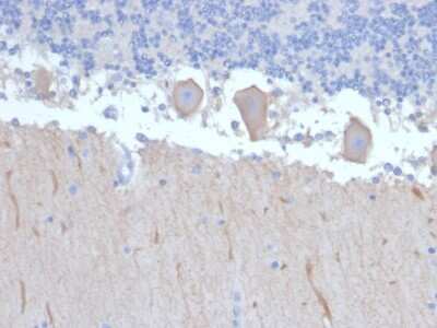 Immunohistochemistry-Paraffin: ATG5 Antibody (ATG5/2492) - Azide and BSA Free [NBP3-08433] - Formalin-fixed, paraffin-embedded human Brain stained with ATG5 Mouse Monoclonal Antibody (ATG5/2492).