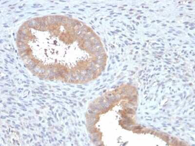 Immunohistochemistry-Paraffin: ATG5 Antibody (ATG5/2553) - Azide and BSA Free [NBP3-08434] - Formalin-fixed, paraffin-embedded human Uterus stained with ATG5 Mouse Monoclonal Antibody (ATG5/2553).