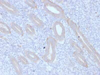 Immunohistochemistry-Paraffin: ATG5 Antibody (ATG5/2553) - Azide and BSA Free [NBP3-08434] - Formalin-fixed, paraffin-embedded human Endometrium stained with ATG5 Mouse Monoclonal Antibody (ATG5/2553).