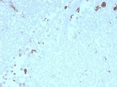 Immunohistochemistry-Paraffin: ATG5 Antibody (rATG5/2553) [NBP3-07881] - Formalin-fixed, paraffin-embedded human Uterus stained with ATG5 Mouse Monoclonal Antibody (rATG5/2553).