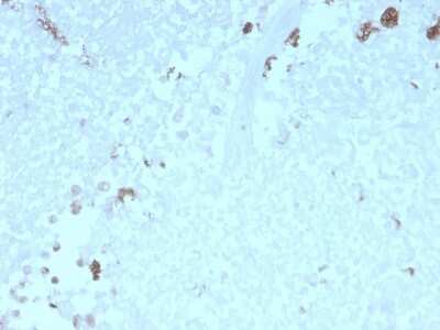 Immunohistochemistry-Paraffin: ATG5 Antibody (rATG5/2553) [NBP3-08452] - Formalin-fixed, paraffin-embedded human Uterus stained with ATG5 Mouse Monoclonal Antibody (rATG5/2553).