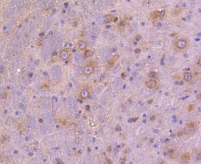 Immunohistochemistry-Paraffin: ATG9A Antibody (SC67-05) [NBP2-67616] - Analysis of paraffin-embedded mouse brain tissue using anti-ATG9A antibody. Counter stained with hematoxylin.