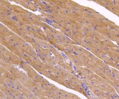Immunohistochemistry-Paraffin: ATG9A Antibody (SC67-05) [NBP2-67616] - Analysis of paraffin-embedded mouse heart tissue using anti-ATG9A antibody. Counter stained with hematoxylin.